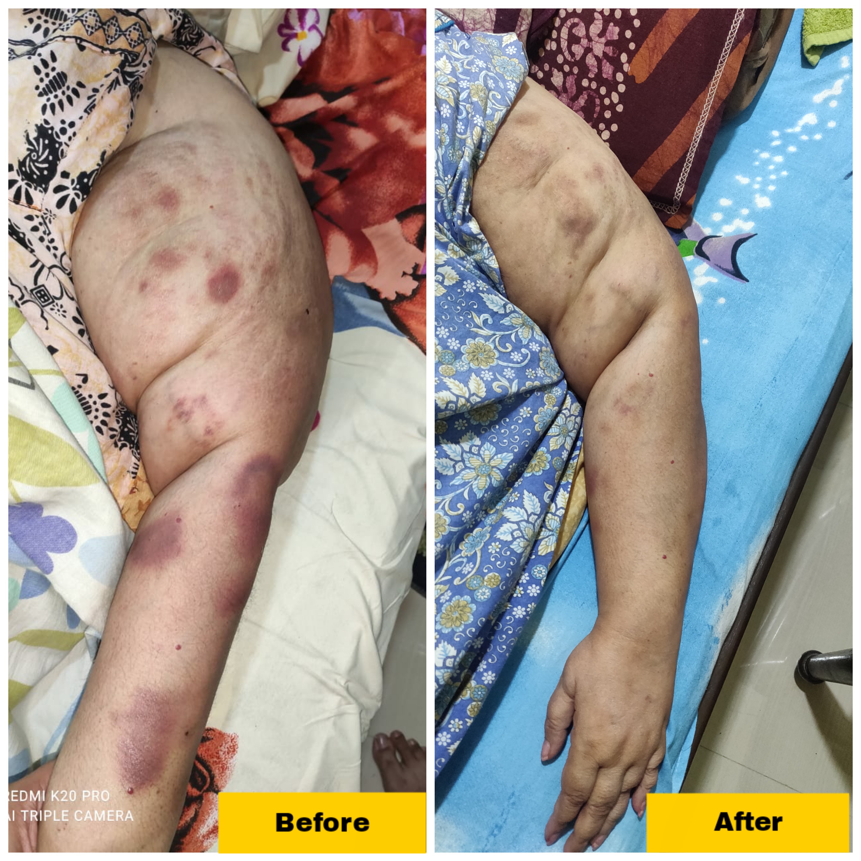 Arthritis Relief